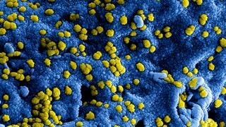 MERS coronavirus particles