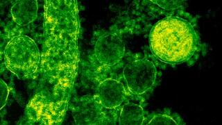 Electron microscopic image of green-coloured MERS-coronavirus particles. Clearly visible are the spike-proteins on the surface of the virus particles that resemble a crown and give the coronavirus its name.