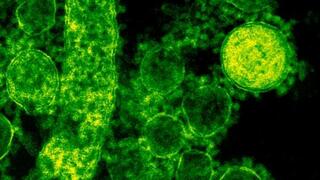 MERS Corona virus particles outside the cell