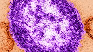 Masernvirus
