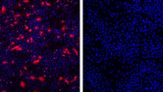 No entry for Hepatitis D viruses (red; left) in hepatocytes with Myrcludex B (right).