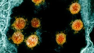 Yellow-orange virus particles in the middle of blue-stained cell tissue