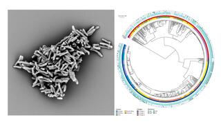 Graue elektronenmikroskopische Aufnahme von stäbchenförmigen Mycobacterium tuberculosis Bakterien; rechte Hälfte: aus der Publikation entnommene Darstellung eines kreisförmigen phylogenetischen Baumes, der die genetischen Verwandschaftsbeziehungen zwischen verschiedenen M. tuberculosis Stämmen anzeigt.