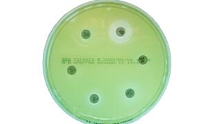 Resistance testing by agar diffusion test