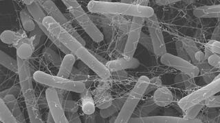 Elektronenmikroskopische Aufnahme eines Haufens stäbchenförmiger Bakterienzellen in grau 
