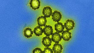 H1N1 influenca virus particle