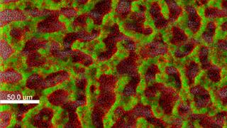 Biofilm of a clinical isolate of Pseudomonas aeruginosa stained with fluorescent dyes