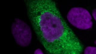 Zu sehen auf schwarzem Hintergrund sind etwa 12 Zellkerne von Lungenzellen in violett sowie ein grün-angefärbter ovaler SARS-CoV-2-Viruspartikel