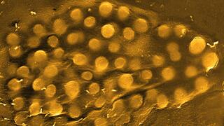 Electron micrograph of a cluster of yellow-stained round bacteria