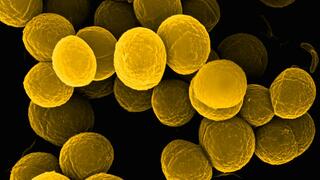 Elektronenmikroskopische Aufnahme von mehreren Zellen des pathogenen Bakteriums Staphylococcus aureus. Die kugelförmigen Bakterienzellen sind gelb gefärbt vor einem dunklen Hintergrund.