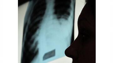 Profile of a man inspecting a lung X-ray image