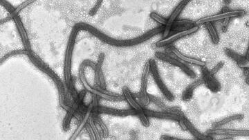 Ebola-Viren im Fokus