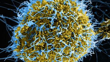 The digitally-colorized scanning electron microscopic (SEM) image depicts numerous filamentous Ebola virus particles (blue) budding from a chronically-infected cell.