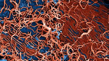Electron microscope image of Ebola viruses