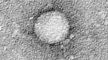 Electron micrograph of a hepatitis C virus particle.