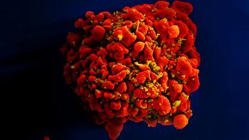 Ein digital eingefärbtes rasterelektronenmikroskopisches Bild einer einzelnen, rot gefärbten T-Zelle, die mit zahlreichen, kugelförmigen, senffarbenen HIV-Partikeln infiziert ist, die an der Oberflächenmembran der Zelle haften.
