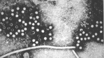 Elektronenmikroskopische Aufnahmen von kugelförmigen Hepatitis-E-Viruspartikeln