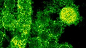 MERS Corona virus particles outside the cell