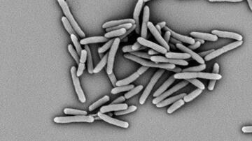 Mycobacterium tuberculosis