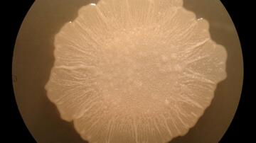 Kultur von Trichosporon asahii auf Sabouraud Agar, 3 Tage/37°C; Auflichtmikroskopie, 40x