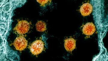 Gelb-orange Viruspartikel inmitten von blaugefärbtem Zellgewebe