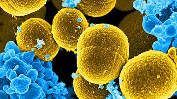 Digital eingefärbte rasterelektronenmikroskopische Aufnahme einer Reihe senffarbener, kugelförmiger Staphylococcus aureus-Bakterien, die von blau gefärbten weißen Blutkörperchen umgeben sind.