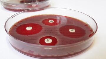 Antibiotikaresistenzen sichtbar machen