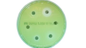 Resistance testing by agar diffusion test