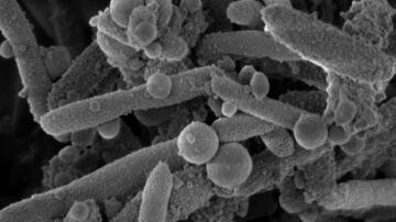Stenotrophomonas maltophilia
