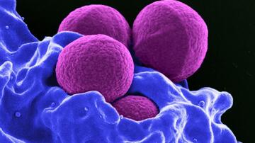 Staphylococcus aureus (magenta-colored)