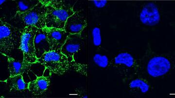 Fluoreszenzmikroskopische Aufnahme von blaugefärbten Zellen auf schwarzem Untergrund, an die in der linken Bildhälfte grüngefärbte Lec A Proteine binden. In der rechten Bildhälfte sind nur blaugefärbte Zellen zu sehen.