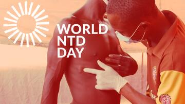 The photo shows a healthcare professional wearing a mask and gloves. She is pointing to nodules under the skin on a patient's bare upper body. A stylized sun and the title “World NTD Day” are displayed in white.
