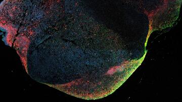 Mehrfarben-Fluoreszenzmikroskopieaufnahme einer mit Ebola-Viren infizierten Zelle.