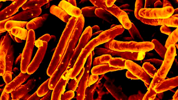 Produced by the National Institute of Allergy and Infectious Diseases (NIAID), this digitally colorized scanning electron microscopic (SEM) image, depicts a large group of orange-colored, rod shaped, Mycobacterium tuberculosis bacteria, which cause tuberculosis (TB) in human beings.