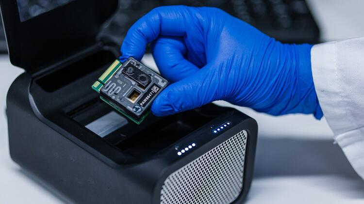 Nanopore DNA-Sequenzierung einer Patientenprobe.